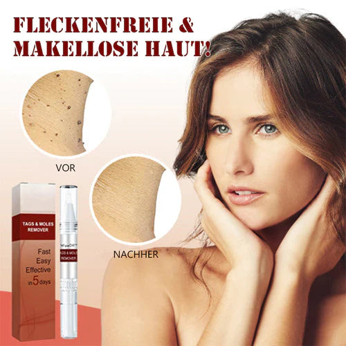 1+1 Gratis! - WipeOff™ Tags & Maulwurfsentferner
