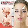 1+1 Gratis! - WipeOff™ Tags & Maulwurfsentferner