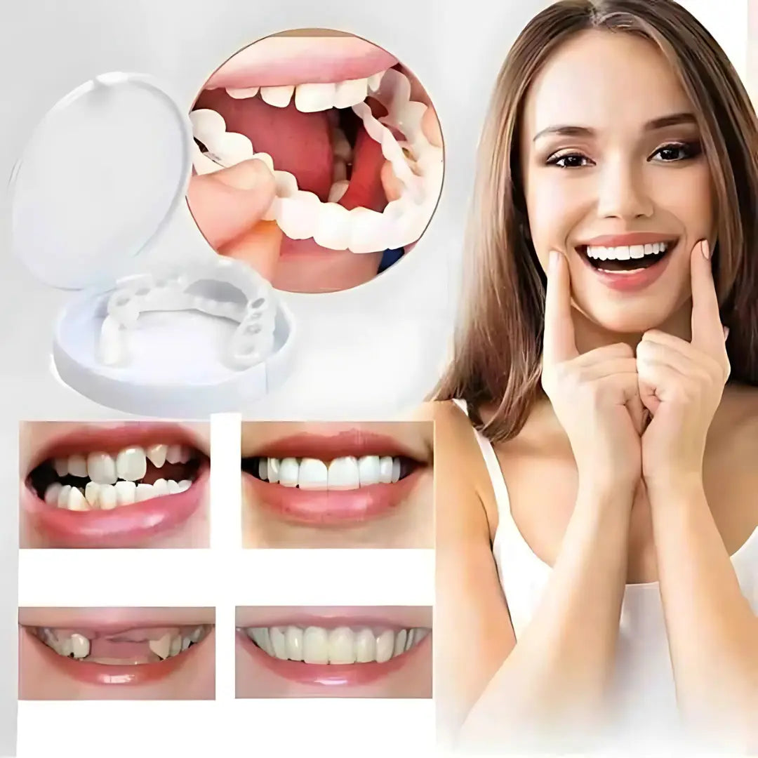 1+1 Gratis | SnapSmiles™ Aufsteckprothesen