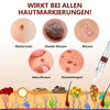 1+1 Gratis! - WipeOff™ Tags & Maulwurfsentferner