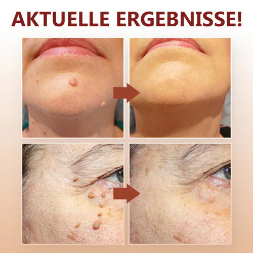 1+1 Gratis! - WipeOff™ Tags & Maulwurfsentferner