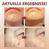 1+1 Gratis! - WipeOff™ Tags & Maulwurfsentferner