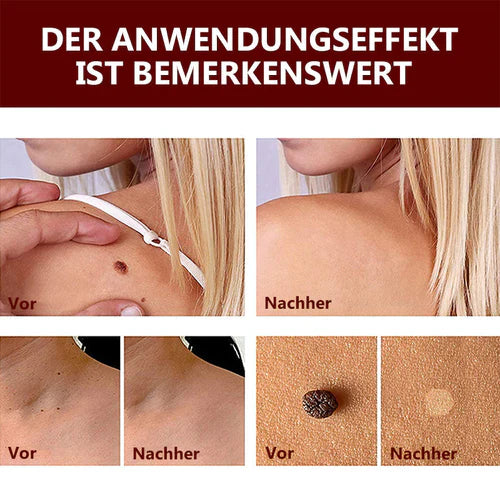 1+1 Gratis! - WipeOff™ Tags & Maulwurfsentferner