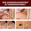 1+1 Gratis! - WipeOff™ Tags & Maulwurfsentferner