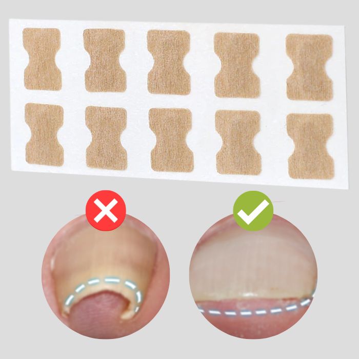 FinePatches™ | Korrekturpflaster für schöne und gesunde Nägel
