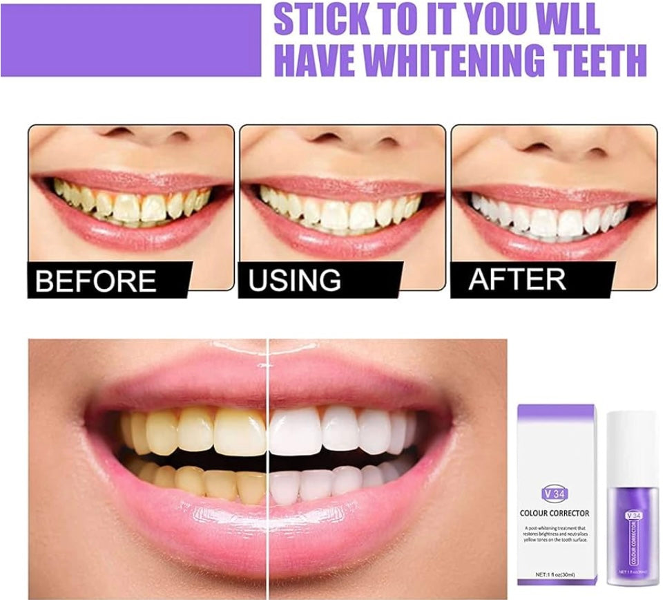 1+1 GRATIS I SmileKit™ | Fühlen Sie sich selbstbewusster mit einem frischen