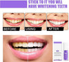 1+1 GRATIS I SmileKit™ | Fühlen Sie sich selbstbewusster mit einem frischen