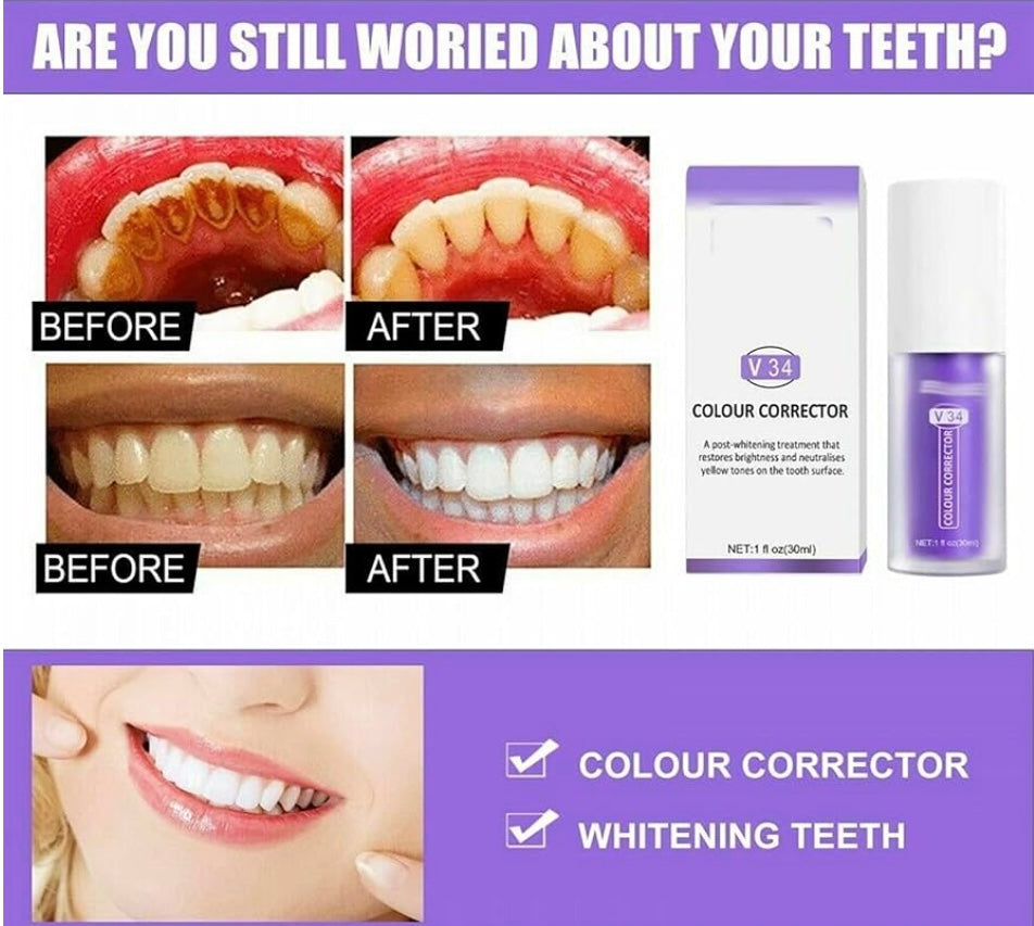 1+1 GRATIS I SmileKit™ | Fühlen Sie sich selbstbewusster mit einem frischen