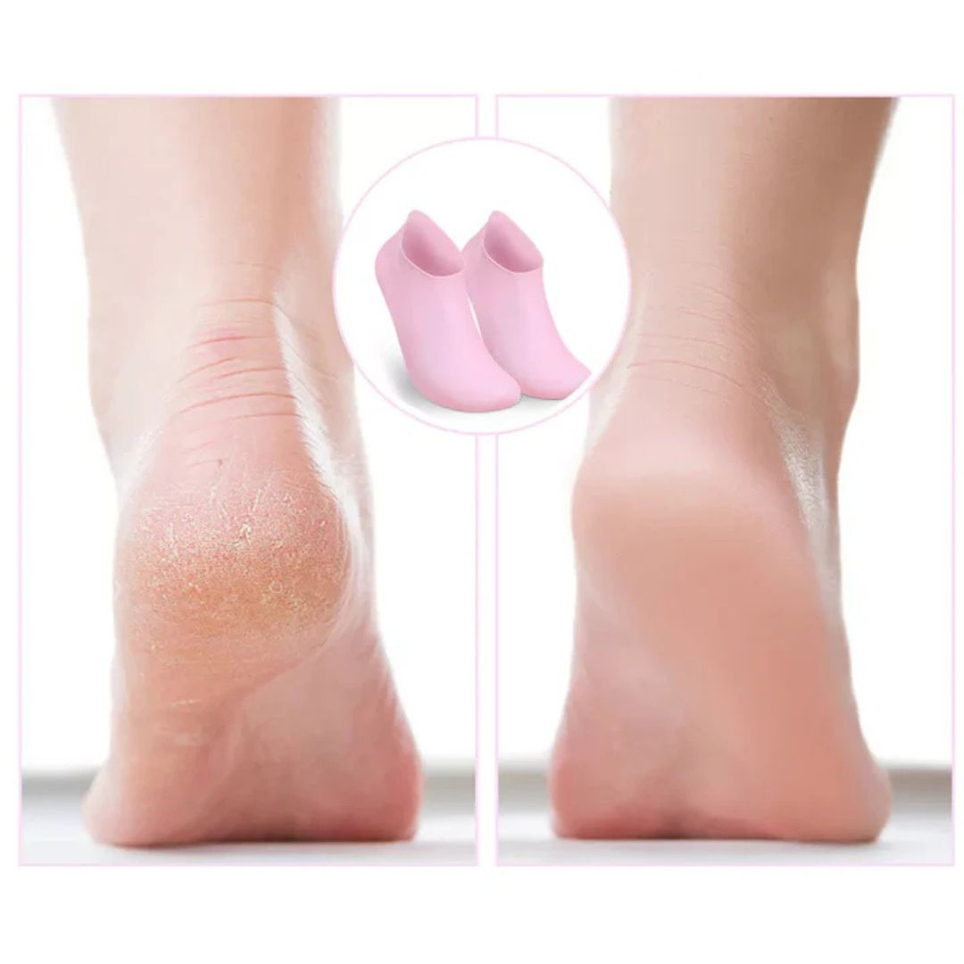 Feeluxe™ – Feuchtigkeitsspendende Pediküresocken für trockene Füße (1+1 Gratis)