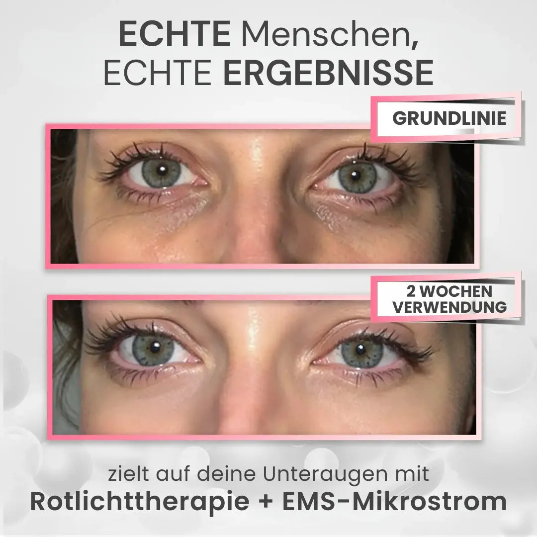RevitalAugen™ Unter-Augen Rotlichttherapie-Gerät | Verjüngte Augen jetzt!
