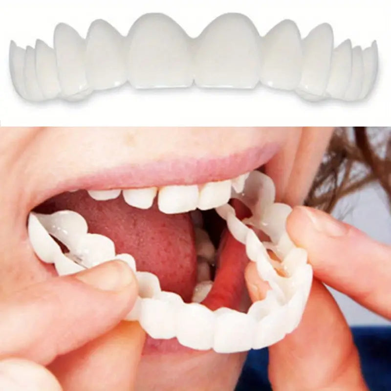 1+1 Gratis | SnapSmiles™ Aufsteckprothesen