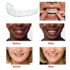 1+1 Gratis | SnapSmiles™ Aufsteckprothesen