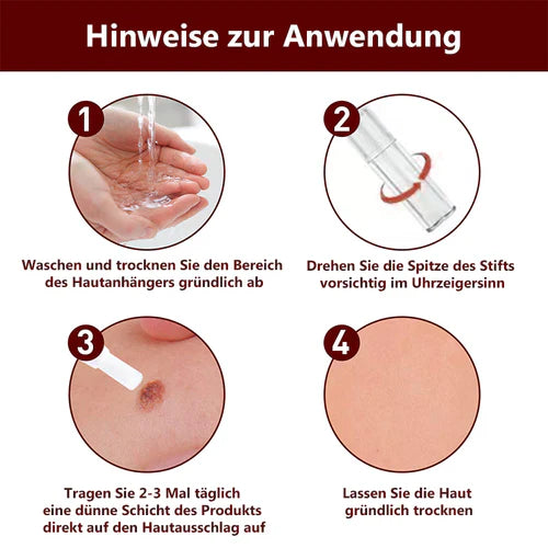 1+1 Gratis! - WipeOff™ Tags & Maulwurfsentferner